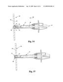 Method and Device for Securely Loading and Mounting a Tubular Device in a Flexible Wall and Manufacturing Method for said Loading Device diagram and image