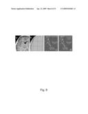 COMPLEX THRESHOLD METHOD FOR REDUCING NOISE IN NUCLEAR MAGNETIC RESONANCE IMAGES diagram and image