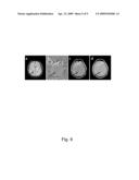 COMPLEX THRESHOLD METHOD FOR REDUCING NOISE IN NUCLEAR MAGNETIC RESONANCE IMAGES diagram and image