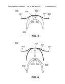 SPECTACLE FRAME BRIDGE HOUSING ELECTRONICS FOR ELECTRO-ACTIVE SPECTACLE LENSES diagram and image