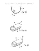 Decoupling device for mounting a shaft on a base and radial ondular washer diagram and image