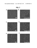 METHODS AND COMPOSITIONS FOR TREATMENT AND DIAGNOSIS OF FIBROSIS, TUMOR INVASION, ANGIOGENESIS, AND METASTASIS diagram and image