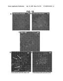 METHODS AND COMPOSITIONS FOR TREATMENT AND DIAGNOSIS OF FIBROSIS, TUMOR INVASION, ANGIOGENESIS, AND METASTASIS diagram and image