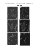 METHODS AND COMPOSITIONS FOR TREATMENT AND DIAGNOSIS OF FIBROSIS, TUMOR INVASION, ANGIOGENESIS, AND METASTASIS diagram and image