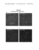 METHODS AND COMPOSITIONS FOR TREATMENT AND DIAGNOSIS OF FIBROSIS, TUMOR INVASION, ANGIOGENESIS, AND METASTASIS diagram and image