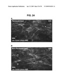 METHODS AND COMPOSITIONS FOR TREATMENT AND DIAGNOSIS OF FIBROSIS, TUMOR INVASION, ANGIOGENESIS, AND METASTASIS diagram and image