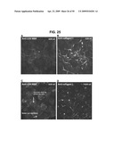 METHODS AND COMPOSITIONS FOR TREATMENT AND DIAGNOSIS OF FIBROSIS, TUMOR INVASION, ANGIOGENESIS, AND METASTASIS diagram and image