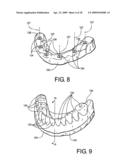 DENTAL FRAMEWORK diagram and image