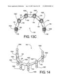 DENTAL FRAMEWORK diagram and image