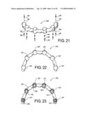 DENTAL FRAMEWORK diagram and image