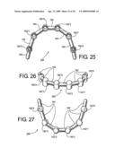 DENTAL FRAMEWORK diagram and image