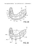 DENTAL FRAMEWORK diagram and image