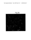 ISOLATION AND TRANSPLANTATION OF RETINAL STEM CELLS diagram and image