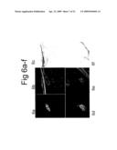 ISOLATION AND TRANSPLANTATION OF RETINAL STEM CELLS diagram and image