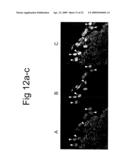 ISOLATION AND TRANSPLANTATION OF RETINAL STEM CELLS diagram and image