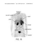 POSITRON EMISSION TOMOGRAPHY PROBES FOR IMAGING IMMUNE ACTIVATION AND SELECTED CANCERS diagram and image