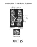 POSITRON EMISSION TOMOGRAPHY PROBES FOR IMAGING IMMUNE ACTIVATION AND SELECTED CANCERS diagram and image