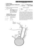 SURGICAL ACCESS SYSTEM AND METHOD OF USING THE SAME diagram and image