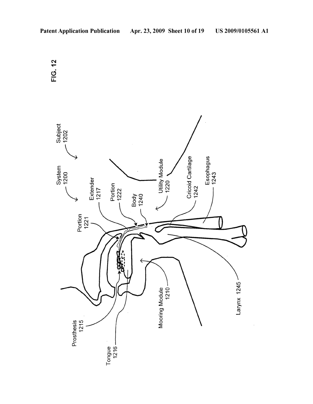 Medical or veterinary digestive tract utilization systems and methods - diagram, schematic, and image 11