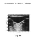 SYSTEM AND METHOD FOR ULTRASONIC HARMONIC IMAGING diagram and image