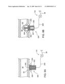SYSTEMS AND METHODS FOR CONTROLLING RENOVASCULAR PERFUSION diagram and image