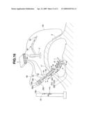 MEDICAL DEVICE diagram and image