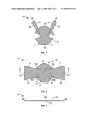 SOFT TISSUE REPAIR IMPLANT diagram and image