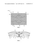 SOFT TISSUE REPAIR IMPLANT diagram and image