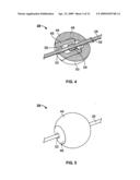 EMBOLIZATION DEVICE AND A METHOD OF USING THE SAME diagram and image