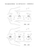 Systems, Devices and Methods for the Correction of Spinal Deformities diagram and image