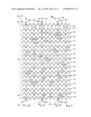 EXPANDABLE STENT diagram and image