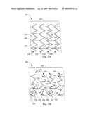 EXPANDABLE STENT diagram and image