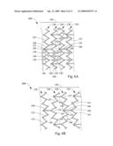 EXPANDABLE STENT diagram and image