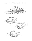 SYSTEM USING A HELICAL RETAINER IN THE DIRECT PLICATION ANNULOPLASTY TREATMENT OF MITRAL VALVE REGURGITATION diagram and image