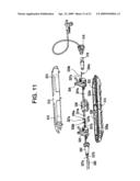 SYSTEM USING A HELICAL RETAINER IN THE DIRECT PLICATION ANNULOPLASTY TREATMENT OF MITRAL VALVE REGURGITATION diagram and image