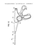 SYSTEM USING A HELICAL RETAINER IN THE DIRECT PLICATION ANNULOPLASTY TREATMENT OF MITRAL VALVE REGURGITATION diagram and image