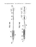 SYSTEM USING A HELICAL RETAINER IN THE DIRECT PLICATION ANNULOPLASTY TREATMENT OF MITRAL VALVE REGURGITATION diagram and image