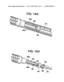 SYSTEM USING A HELICAL RETAINER IN THE DIRECT PLICATION ANNULOPLASTY TREATMENT OF MITRAL VALVE REGURGITATION diagram and image