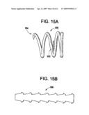 SYSTEM USING A HELICAL RETAINER IN THE DIRECT PLICATION ANNULOPLASTY TREATMENT OF MITRAL VALVE REGURGITATION diagram and image