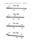 SYSTEM USING A HELICAL RETAINER IN THE DIRECT PLICATION ANNULOPLASTY TREATMENT OF MITRAL VALVE REGURGITATION diagram and image