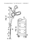 SYSTEM USING A HELICAL RETAINER IN THE DIRECT PLICATION ANNULOPLASTY TREATMENT OF MITRAL VALVE REGURGITATION diagram and image