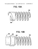 SYSTEM USING A HELICAL RETAINER IN THE DIRECT PLICATION ANNULOPLASTY TREATMENT OF MITRAL VALVE REGURGITATION diagram and image