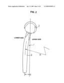 Artificial elbow joint diagram and image