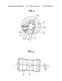 Artificial elbow joint diagram and image