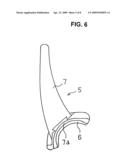 Artificial elbow joint diagram and image