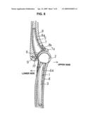 Artificial elbow joint diagram and image