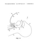 System for providing an open airway and methods of use thereof diagram and image