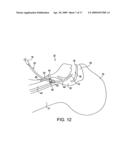 System for providing an open airway and methods of use thereof diagram and image