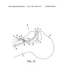 System for providing an open airway and methods of use thereof diagram and image