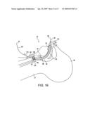 System for providing an open airway and methods of use thereof diagram and image